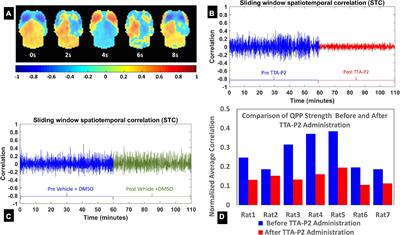 Selective blockade of rat brain T-type calcium channels provides insights on neurophysiological basis of arousal dependent resting state functional magnetic resonance imaging signals